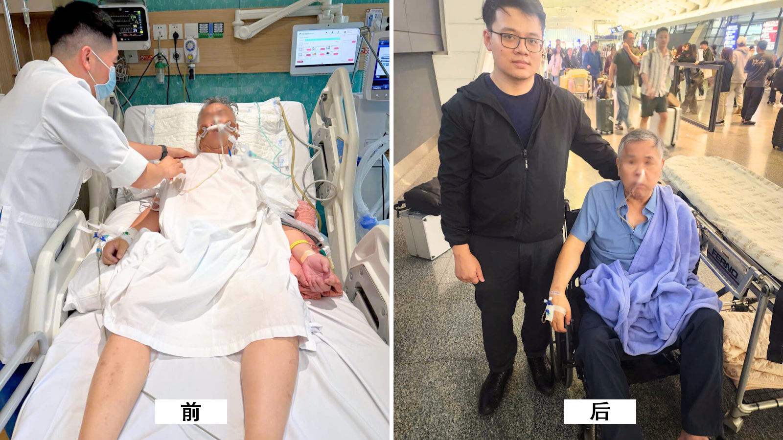 患者钟Y.L.在红玉综合医院治疗前后对比