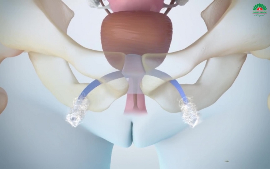 người bệnh Ukraine phẫu thuật TOT