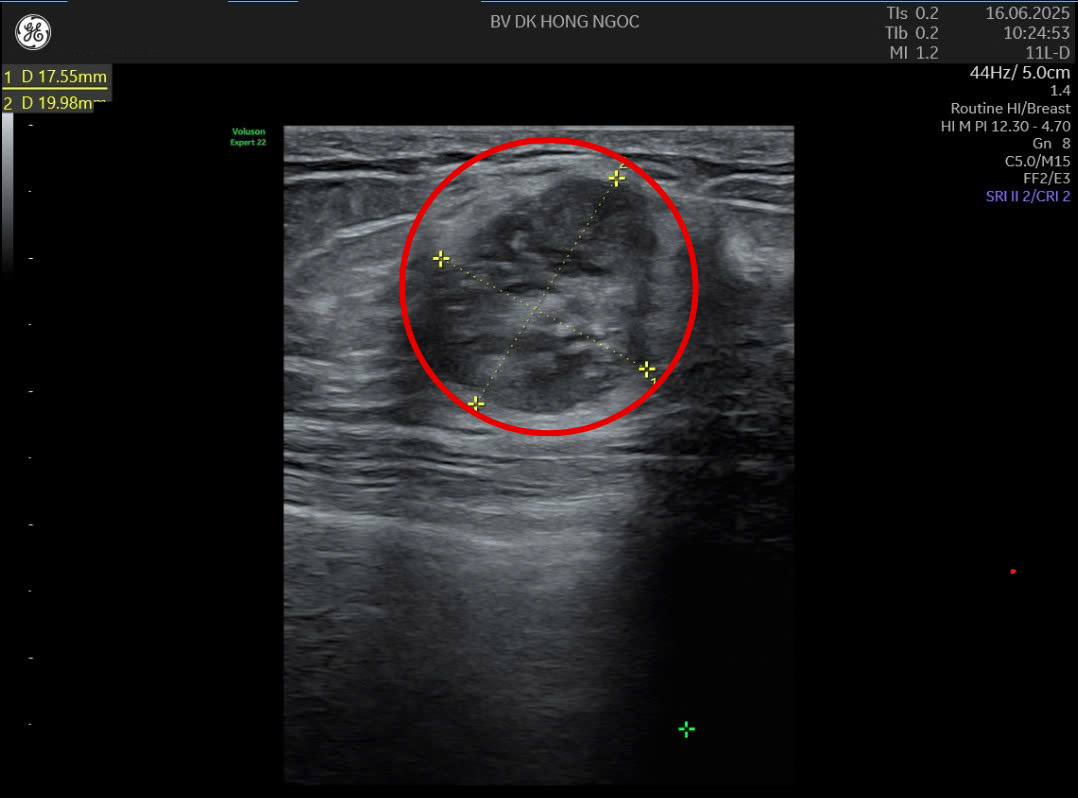 Thiết Kế Chưa Có Tên