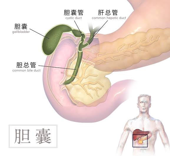 胆囊息肉