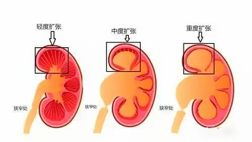 0 Dị Tật đg Tl
