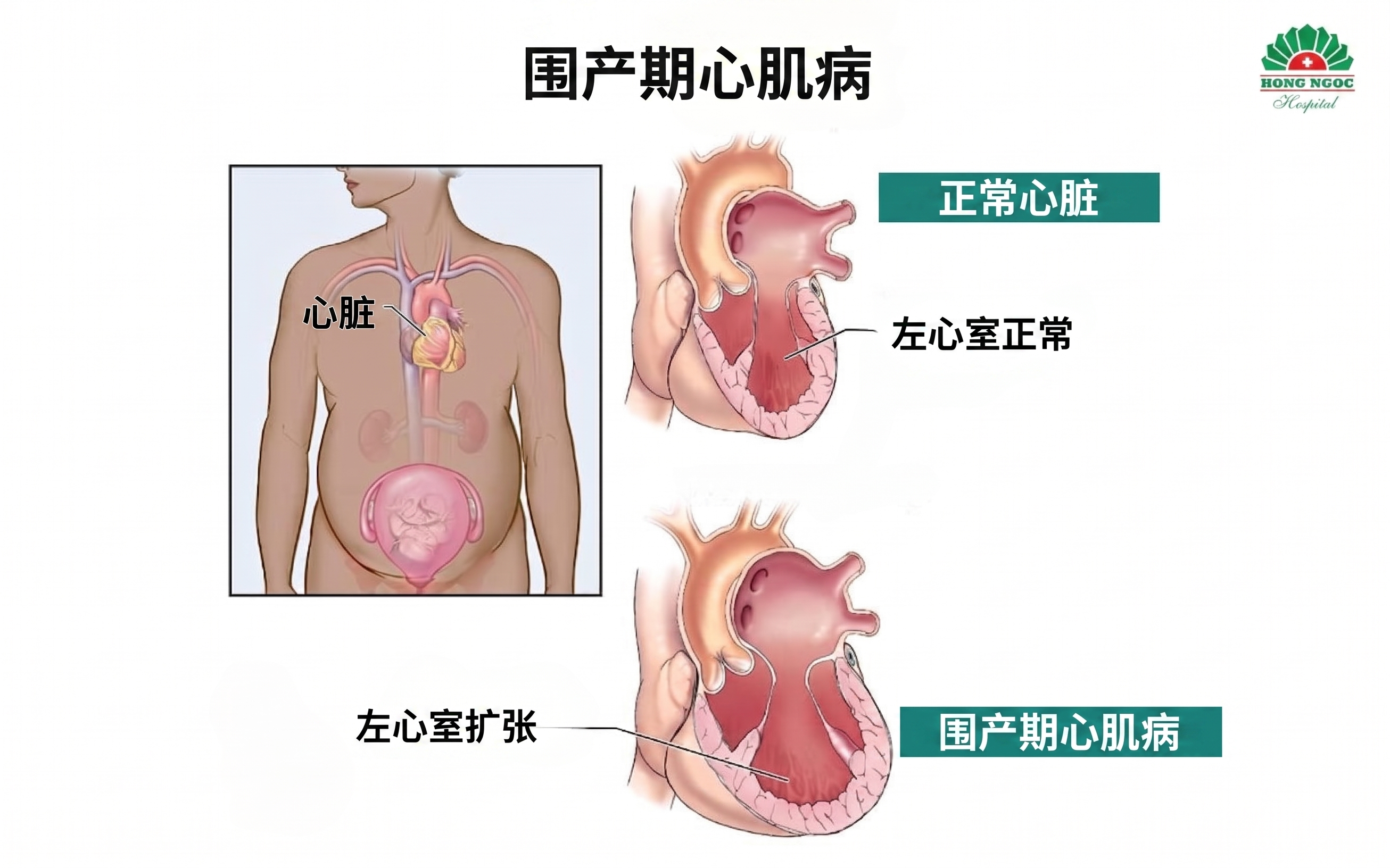 正常孕产妇与患病孕产妇的影像学对比
