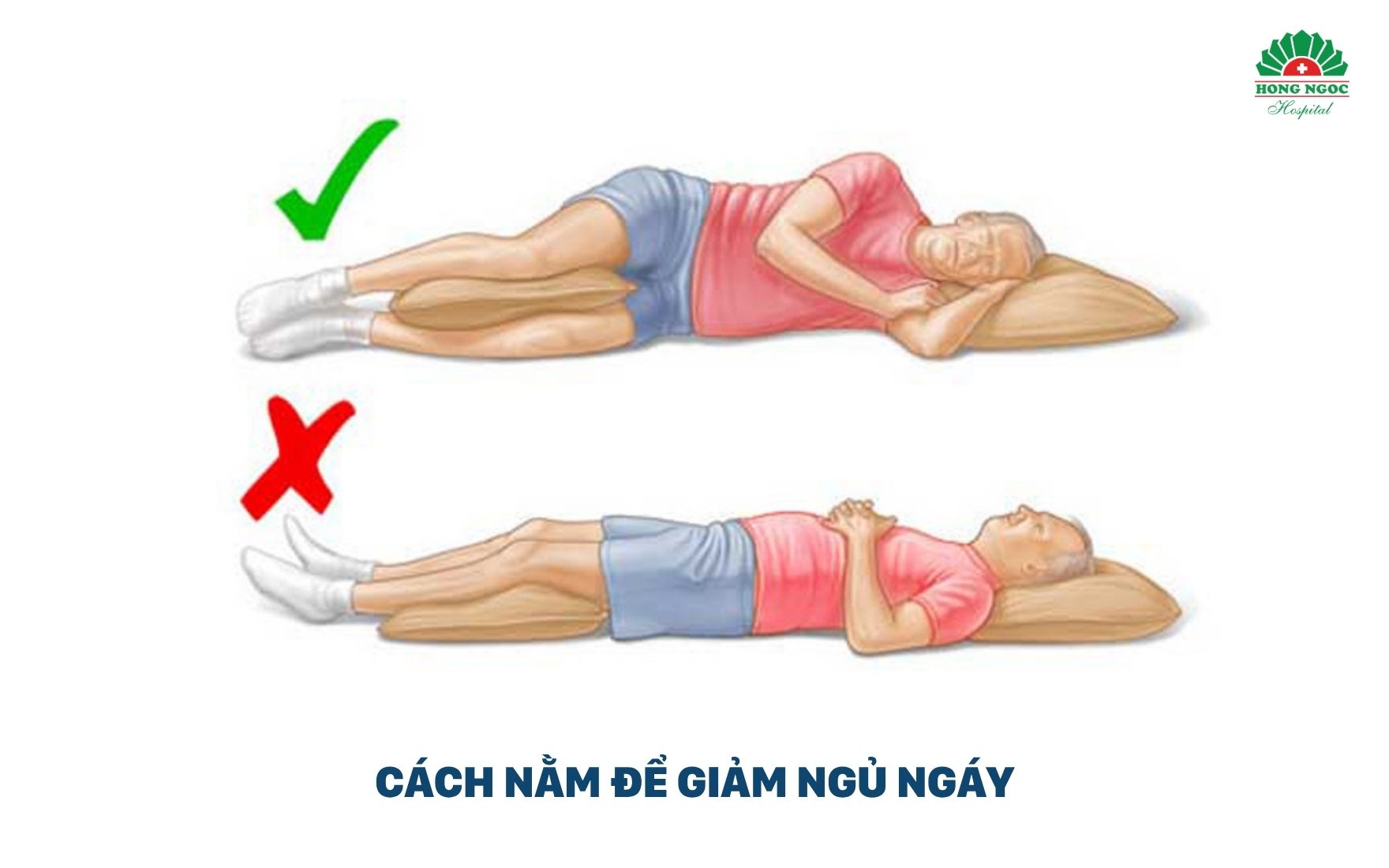 인후 근육 운동은 전문의들이 권장하는 효과적인 수면무호흡 관리법입니다.