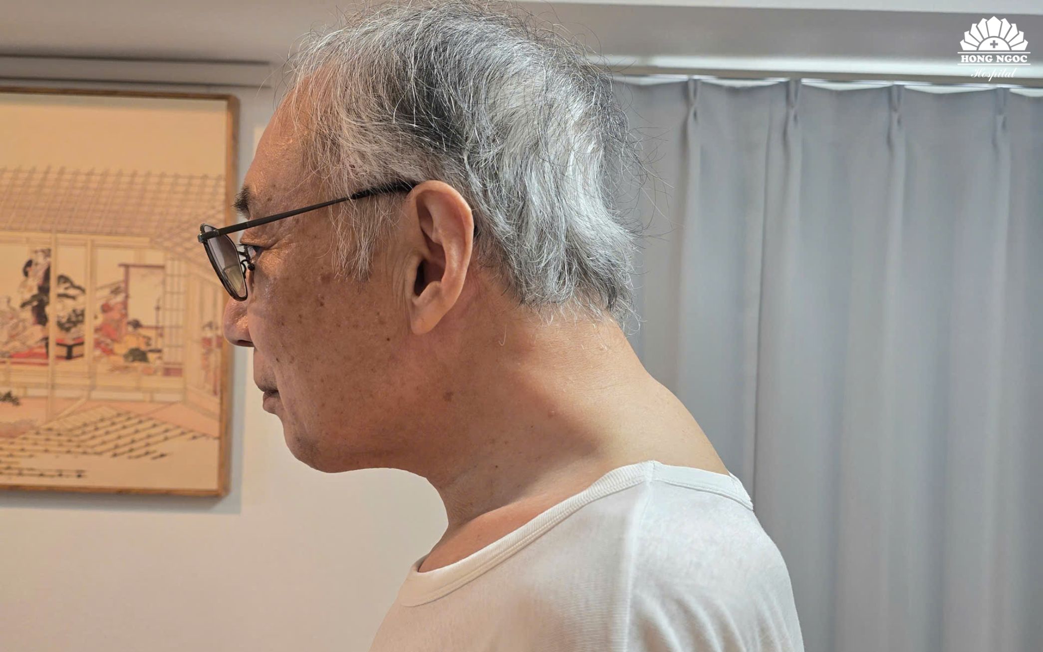 척추 감염으로 인해 환자의 목이 항상 굽은 자세를 유지하며, 돌리거나 젖힐 수 없습니다.