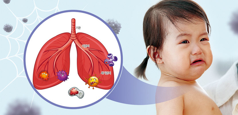 소아 모세기관지염