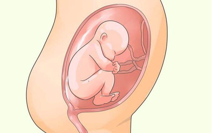 증상이 심각할 경우 양수과다증으로 인해 조기 임신 중단이 필요할 수 있습니다.