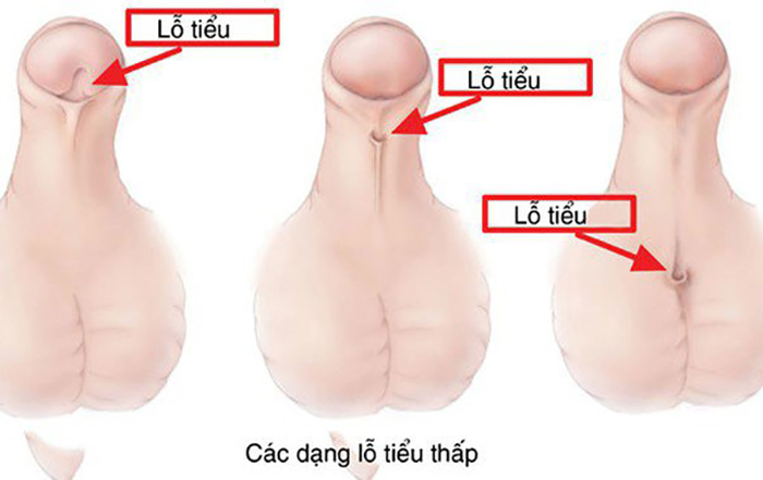 우리 아이, 이런 증상이 있다면 의심해 보세요!