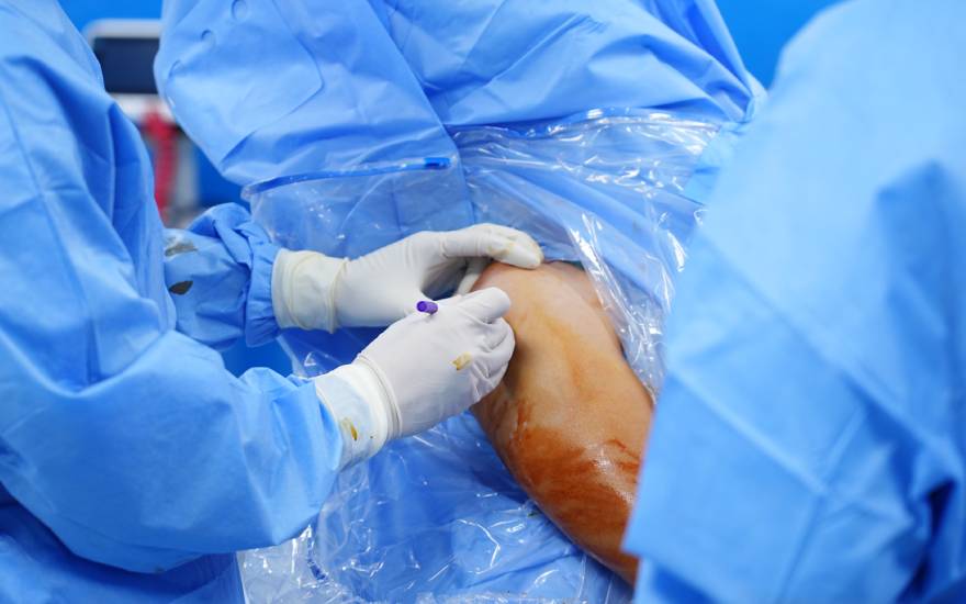 홍옥 종합병원에서의 어깨 관절 강직 치료