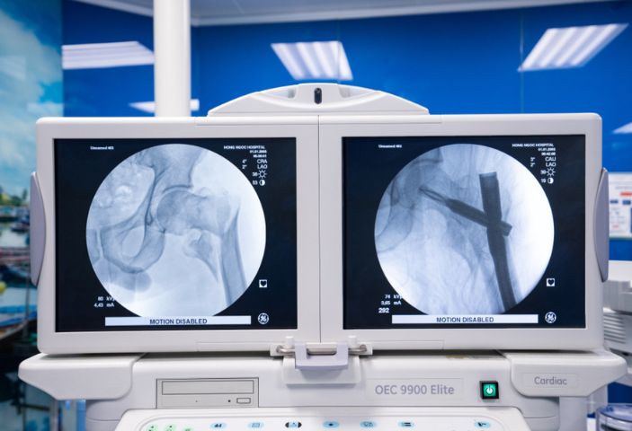 생체 내 골 유합술 - 수술 후 1일차 활동 가능
