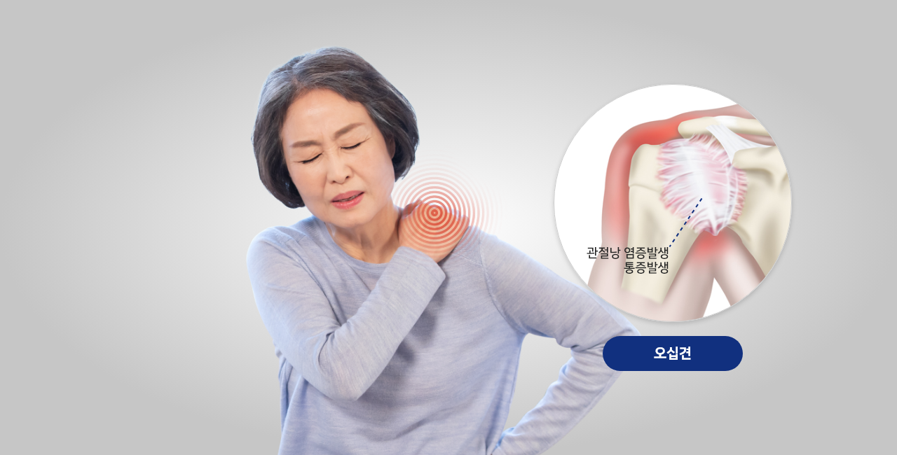 외상, 염증, 질병 등이 어깨 오십견(동결견)의 원인입니다.