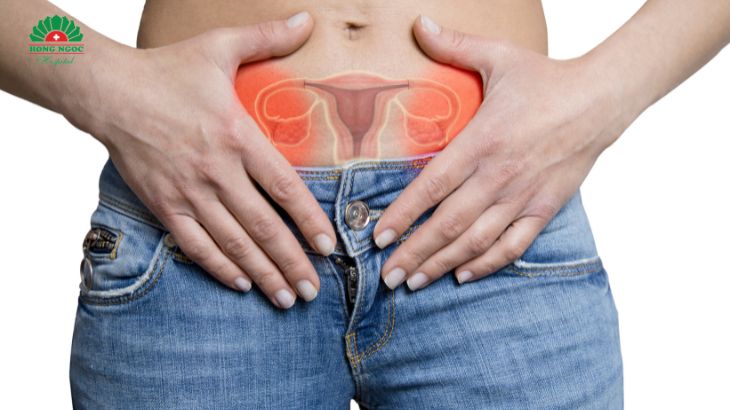 자궁경부 나보트 낭종은 완치되기 어렵습니다.