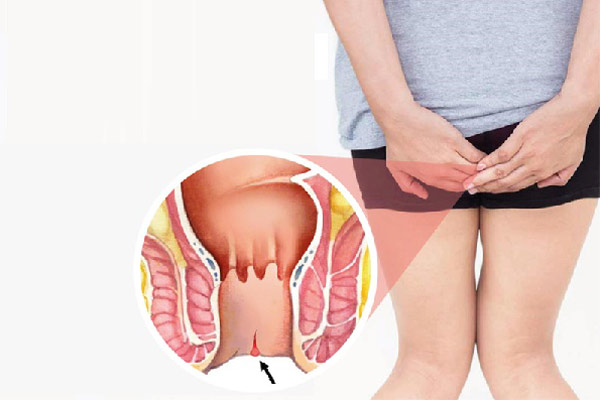 치열 환자는 식습관을 바꾸고 녹색 채소를 자주 보충해야 합니다