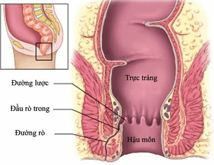 Ro Hau Mon 2