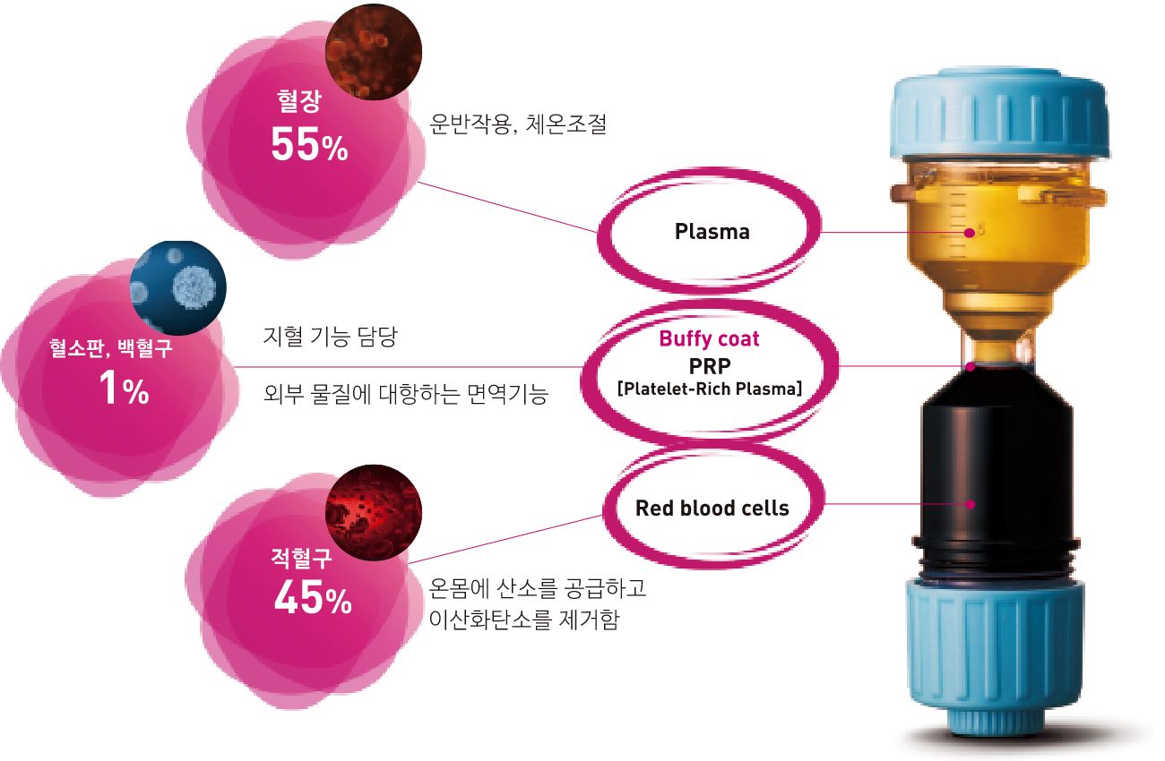 PRP(자가 혈소판 풍부 혈장) 주사