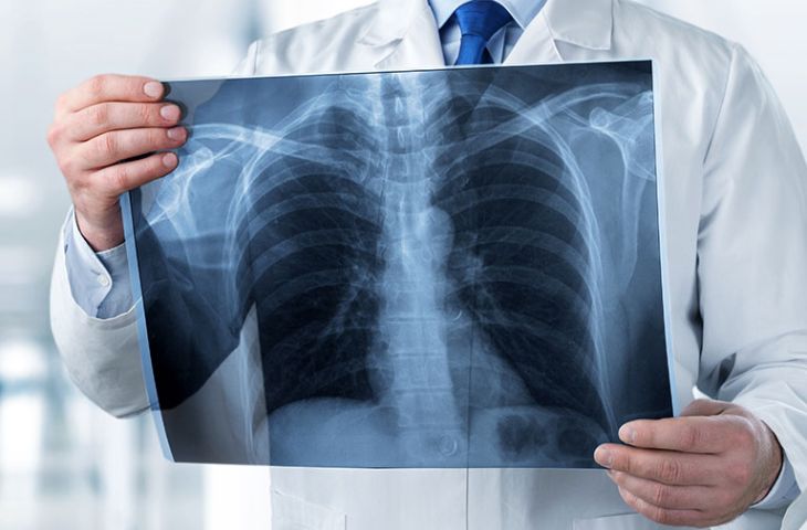 X-ray 촬영은 허리 디스크(추간판 탈출증)을 정확하게 진단하는 데 도움이 됩니다.