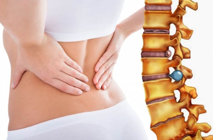 적절한 운동은 허리디스크 증상을 예방하고 신체를 건강하게 만듭니다.