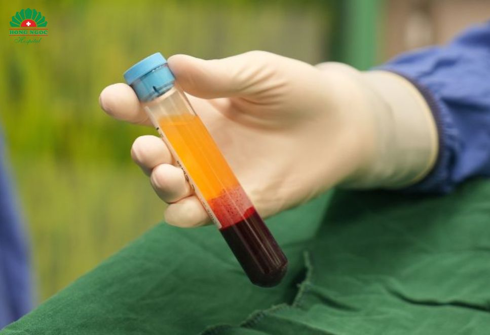 손상된 힘줄 부위 물리치료