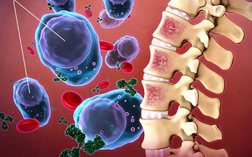 골수염은 크게 3가지 경로를 통해 확산됩니다.