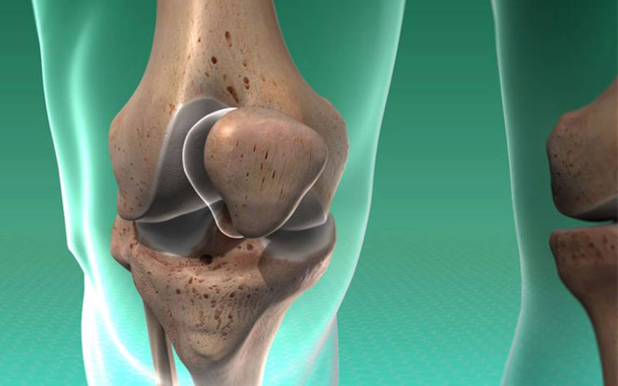 무릎 관절의 슬개골 구조 이미지