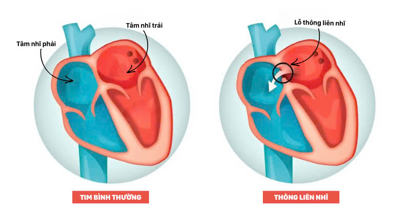 ẢNH 1