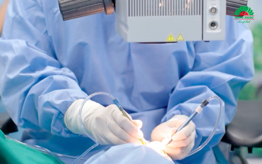 Phẫu thuật Phaco ứng dụng hệ thống Centurion