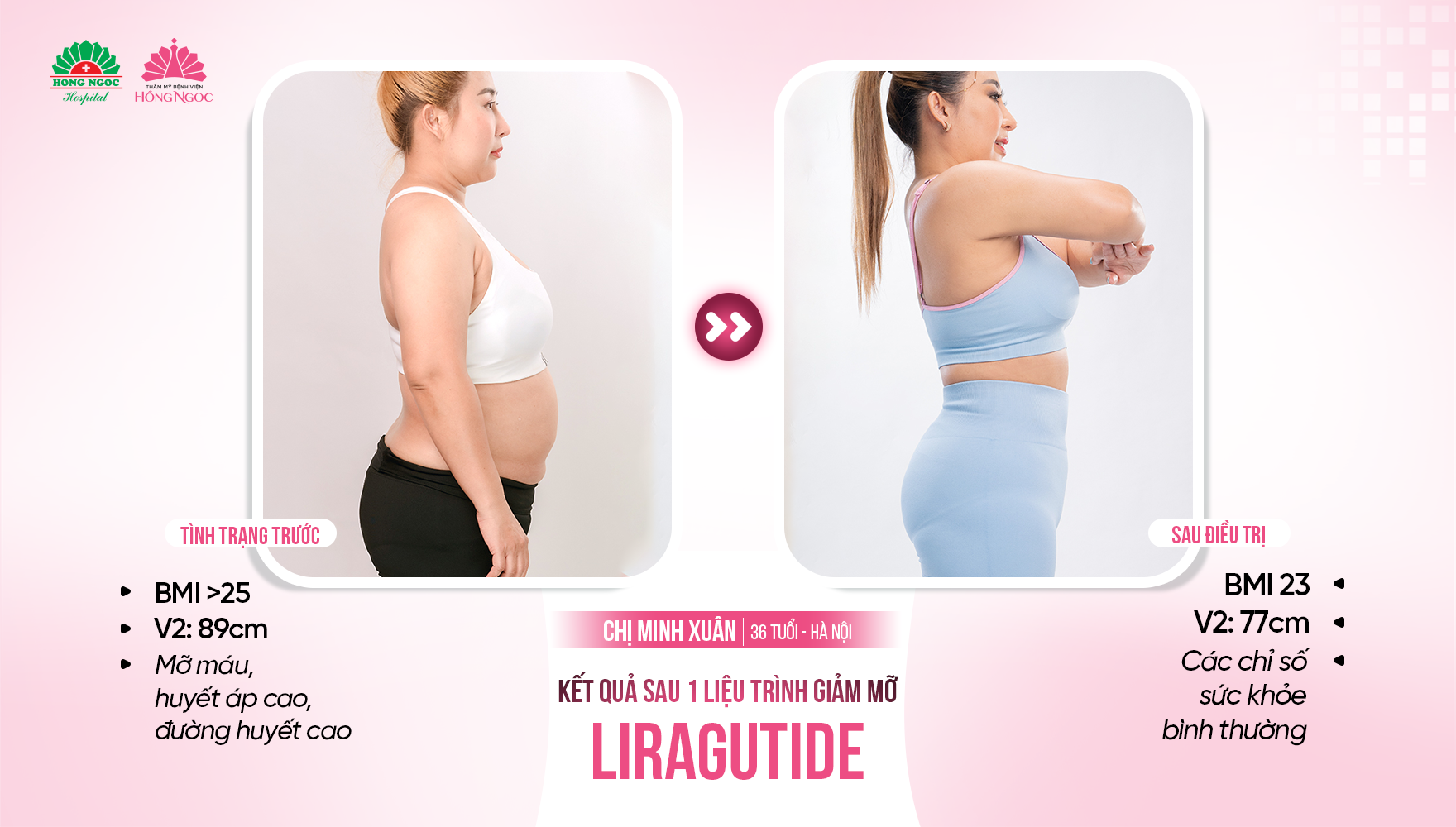 giảm béo Liraglutide