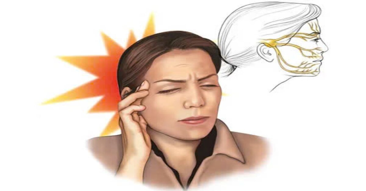 Các cách điều trị đau dây thần kinh số 5 nâng cao chất lượng ...