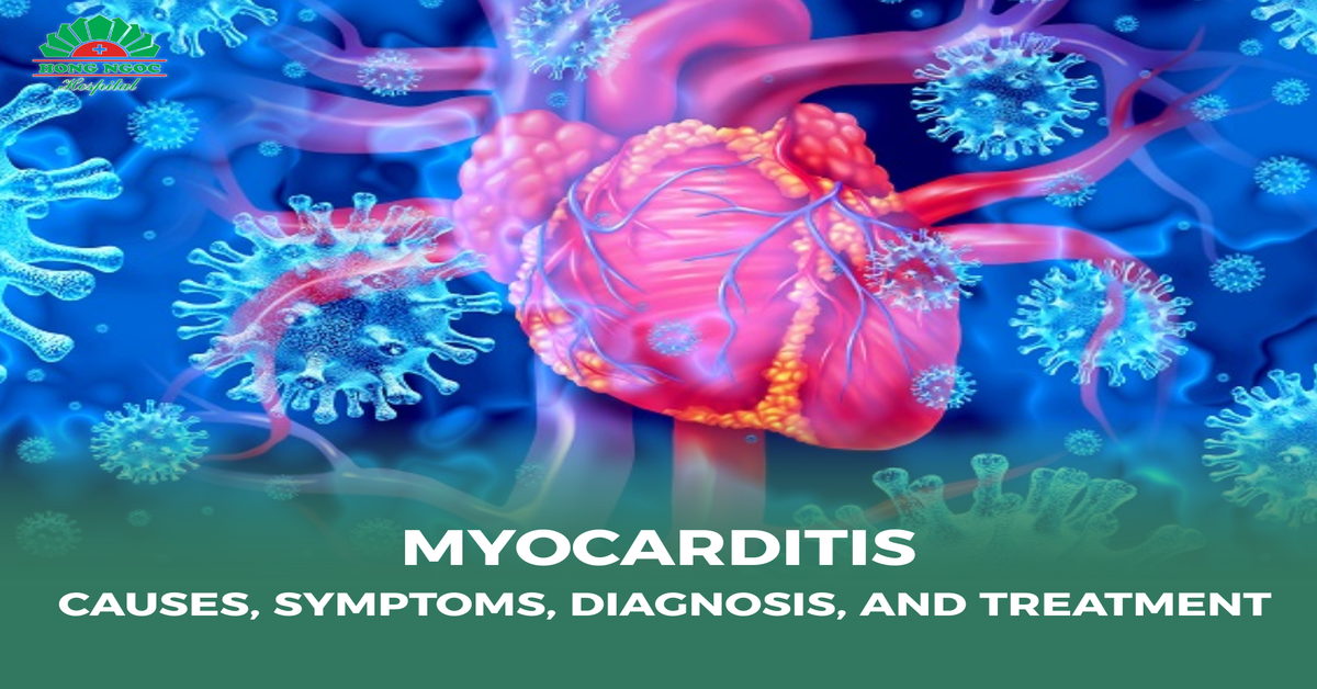 Myocarditis: Causes, symptoms, diagnosis, and treatment
