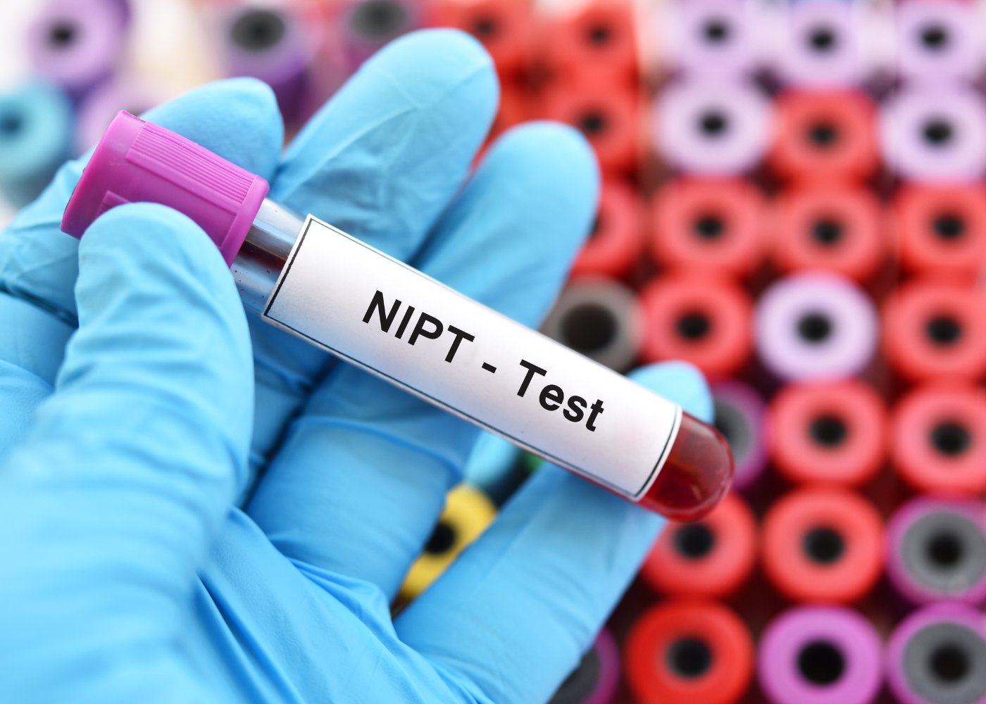 CHÍCH ÁP XE VÚ (2)