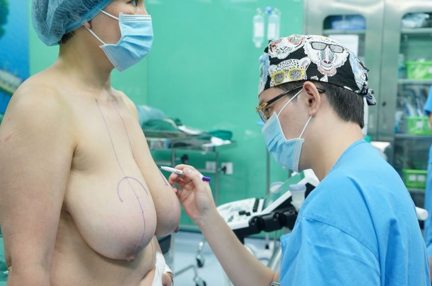 nâng ngực sa trễ