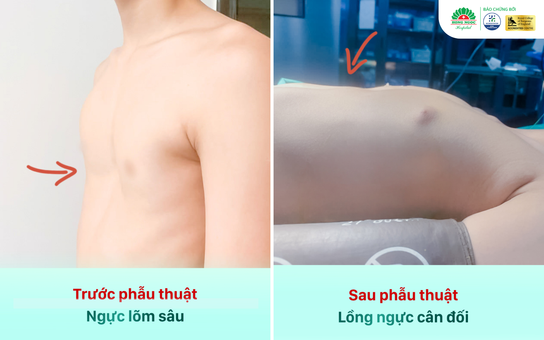 Hô Hấp   Bài Quốc Tế (1) 2