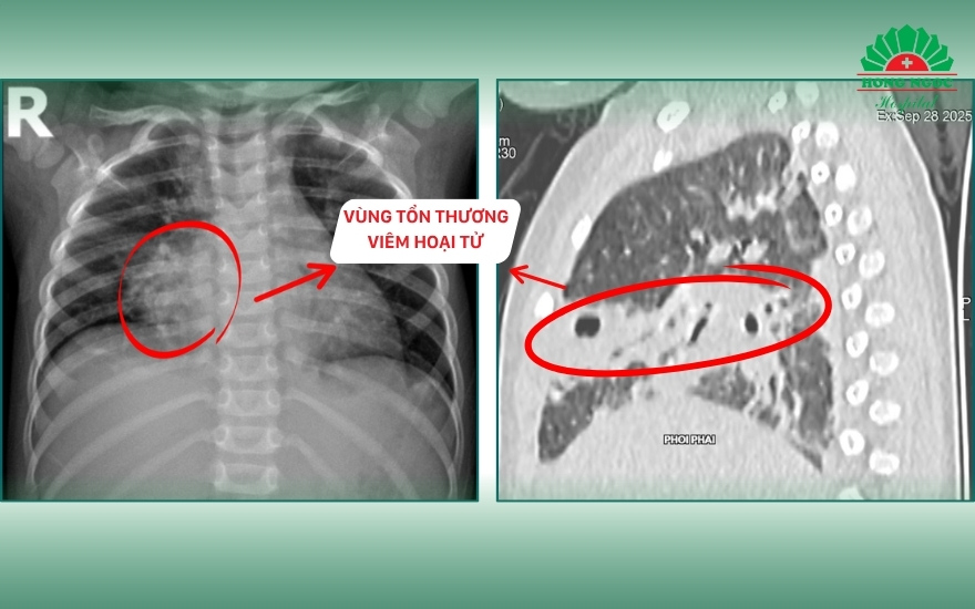 Khoa Nhi   Ngọc (3)