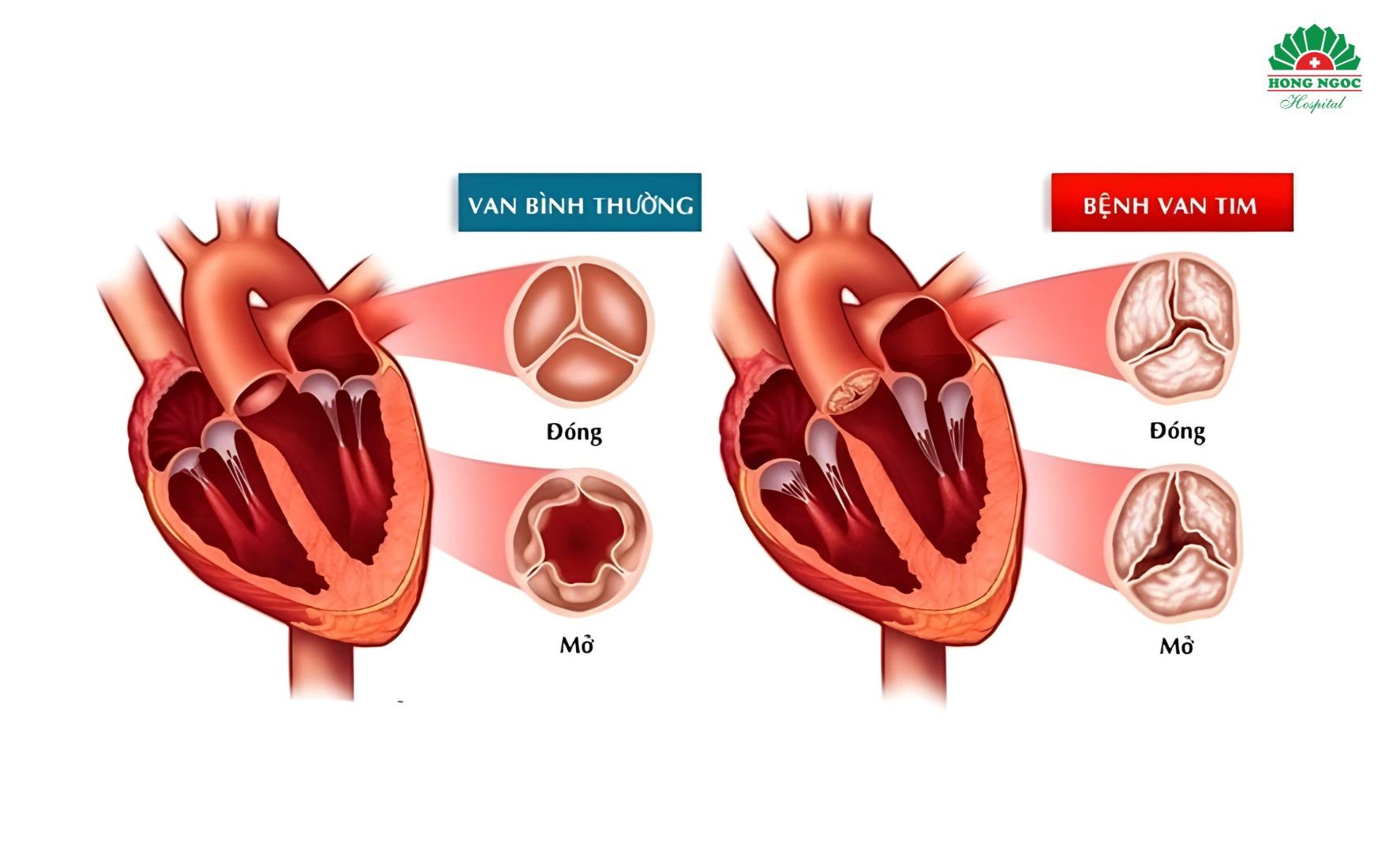THONG SAN NHI THAT (1)