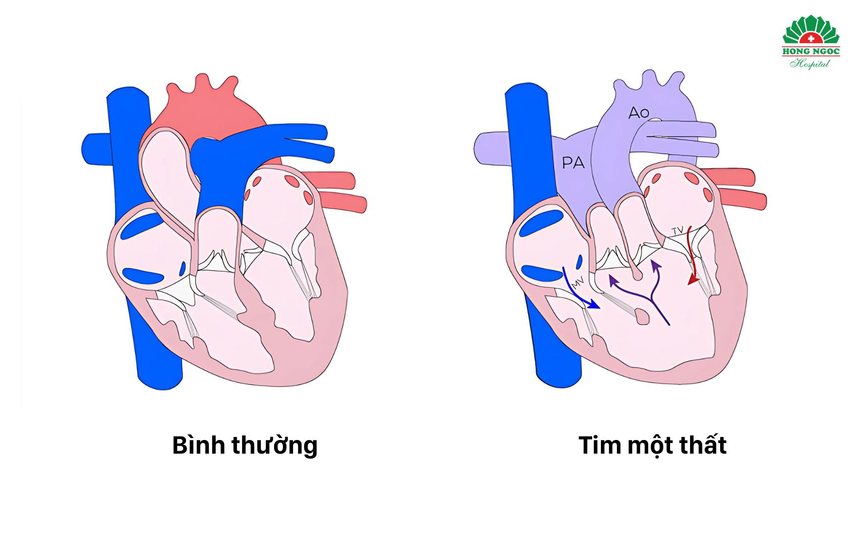TIM MOT THAT KK