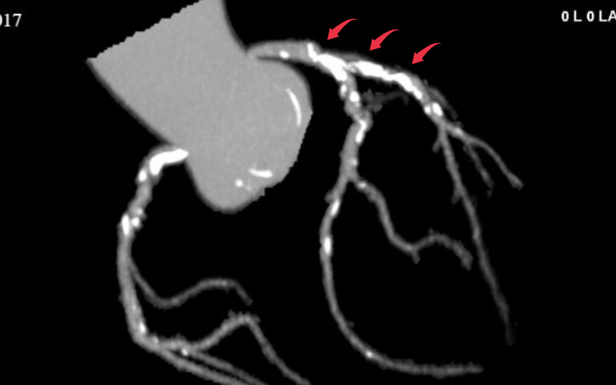 Thiết Kế Chưa Có Tên (6) 4