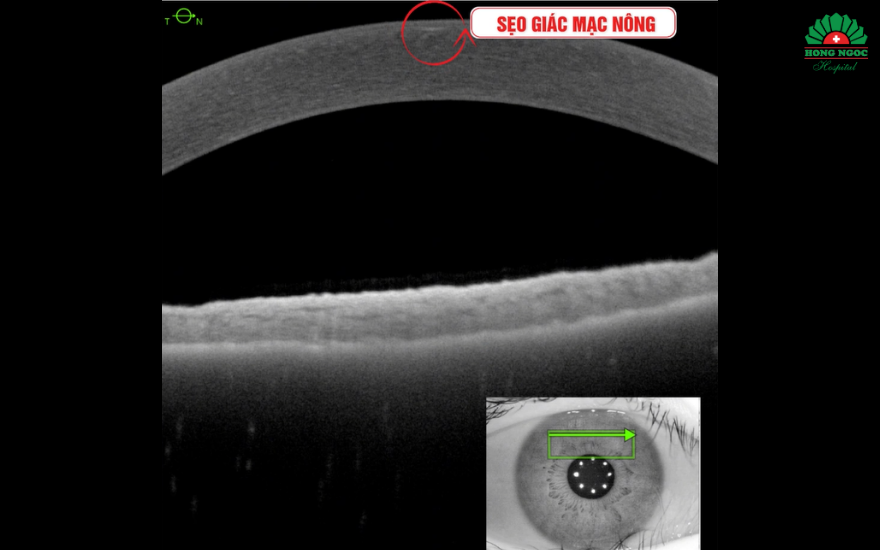 Thiết Kế Chưa Có Tên 11