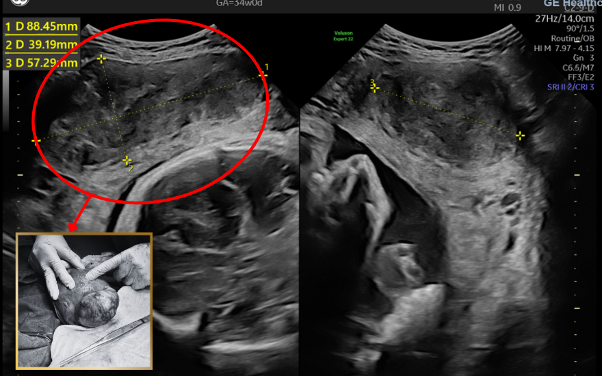 Tuyet   Branding (10)