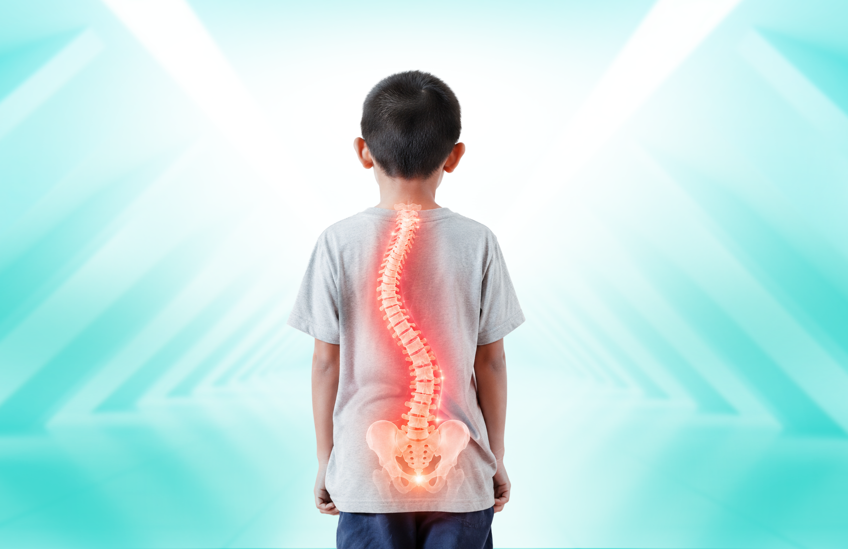cong vẹo cột sống ảnh hưởng sự phát triển của trẻ