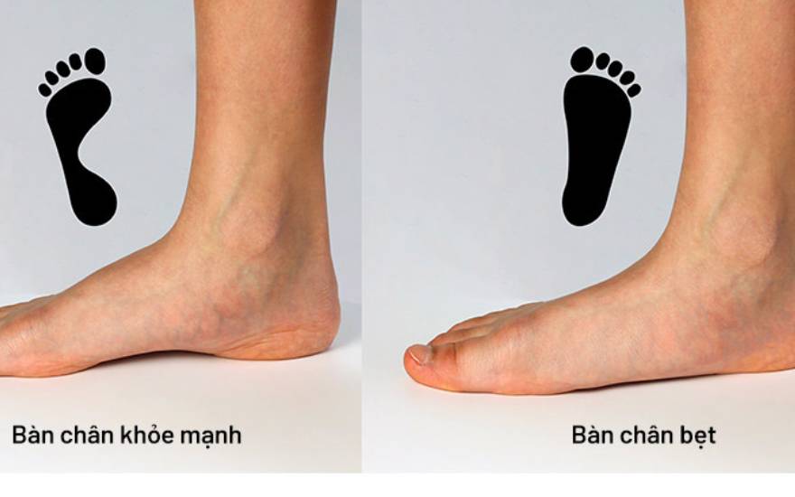phẫu thuật dị tật bẩm sinh ở chân