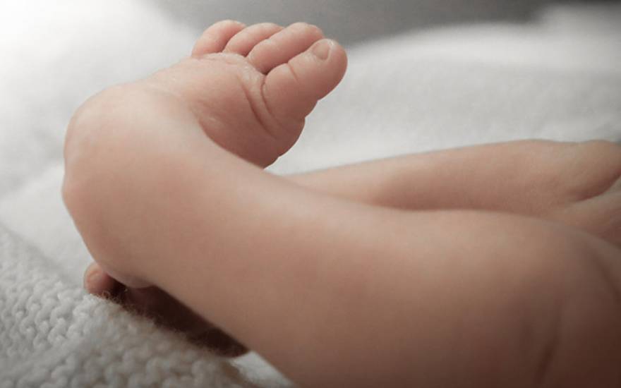 bàn chân khoèo bẩm sinh