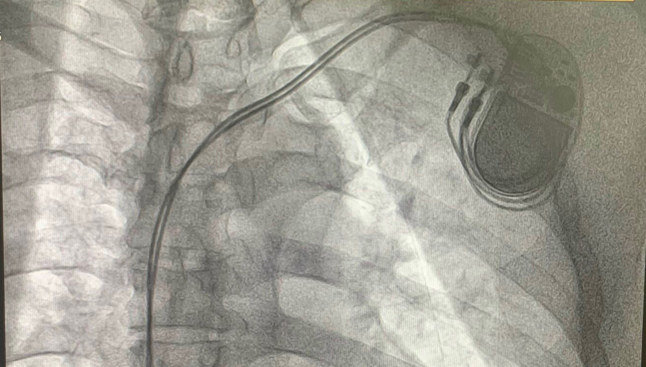 Cay May Tao Nhip Tim Vinh Vien 4