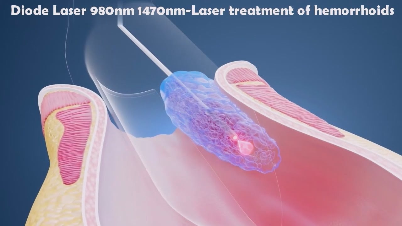 chua-tri-o-benh-vien-nao-tot