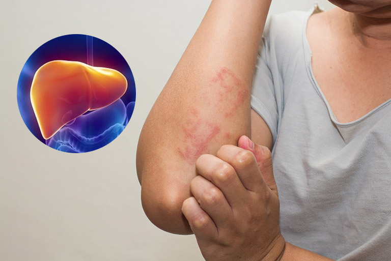 Chuc Nang Gan Hongngoc Hospital