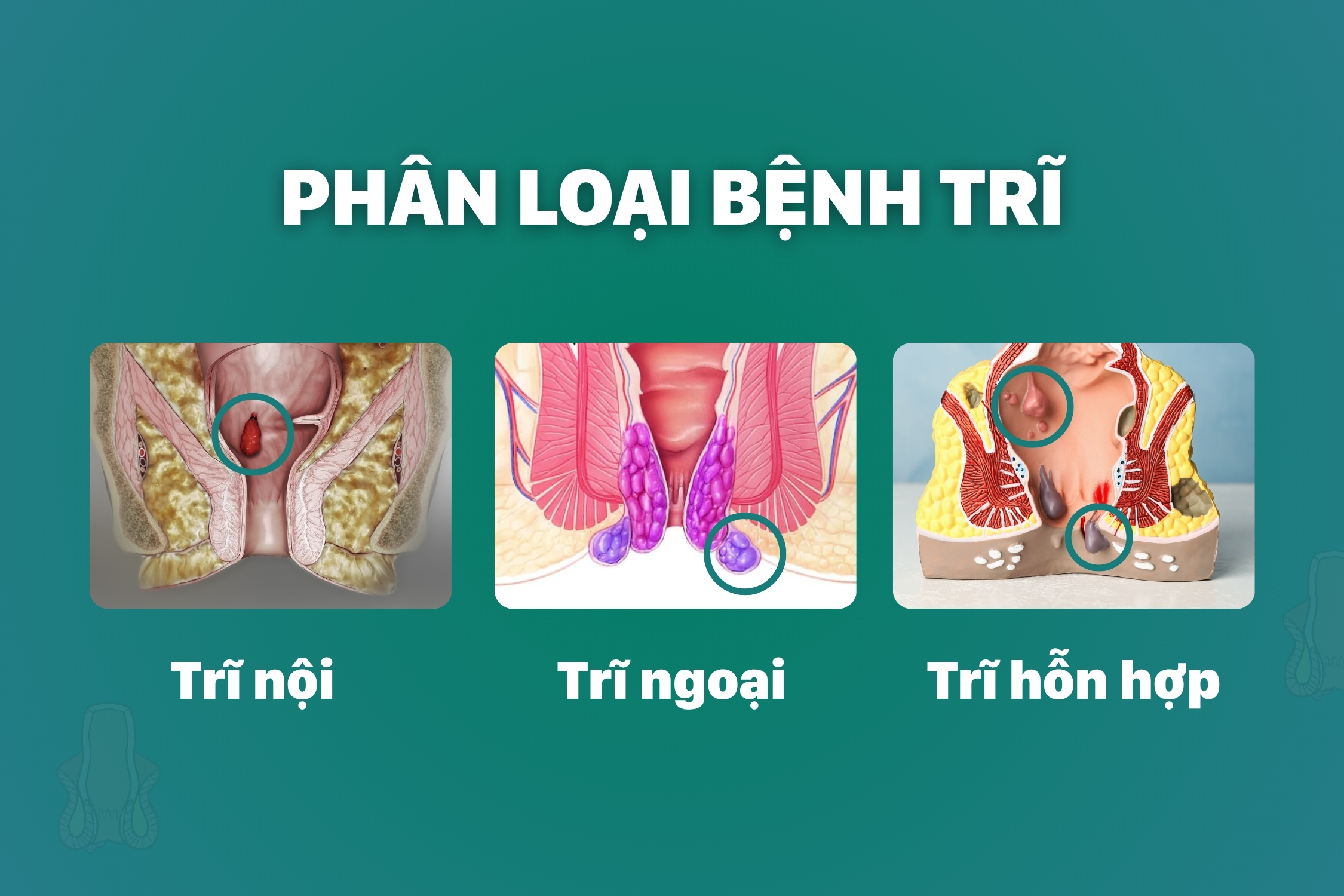 dau-hieu-tri-ngoai