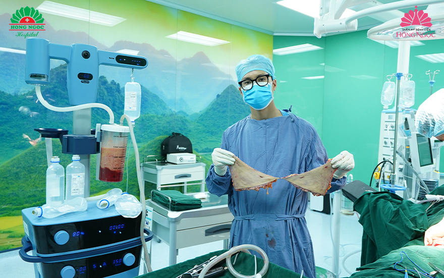 tạo hình thành bụng có chuyển rốn