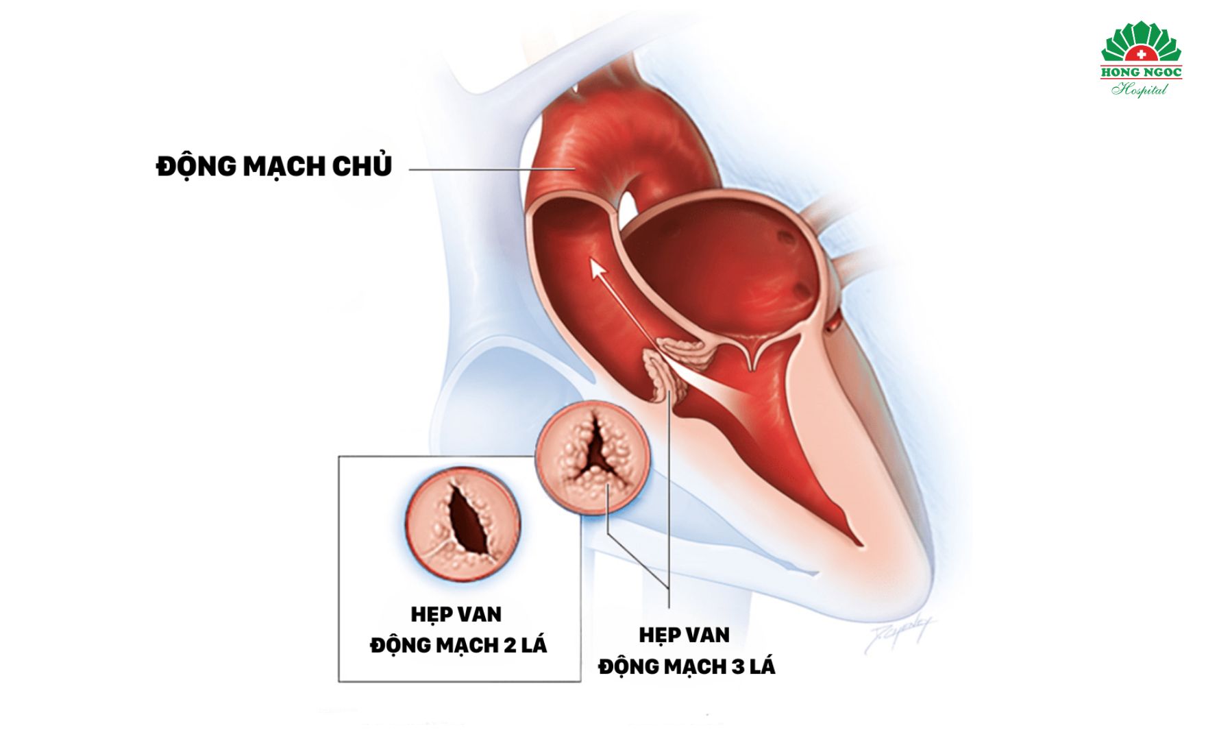 Hep Van Dong Mach Chu Dieu Can Biet (2)