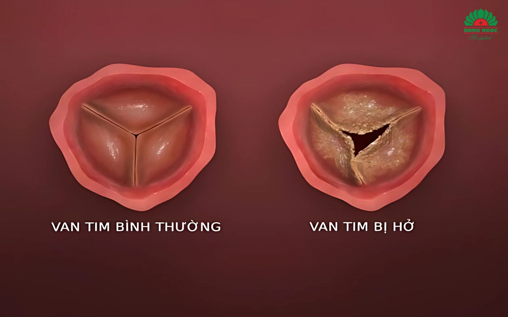 Ho Van Dong Mach Chu 1 4 La Gi (2)