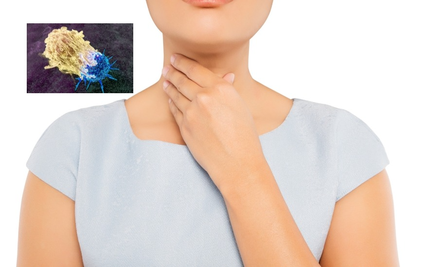 Một số ung thư vùng hầu họng có thể liên quan đến HPV