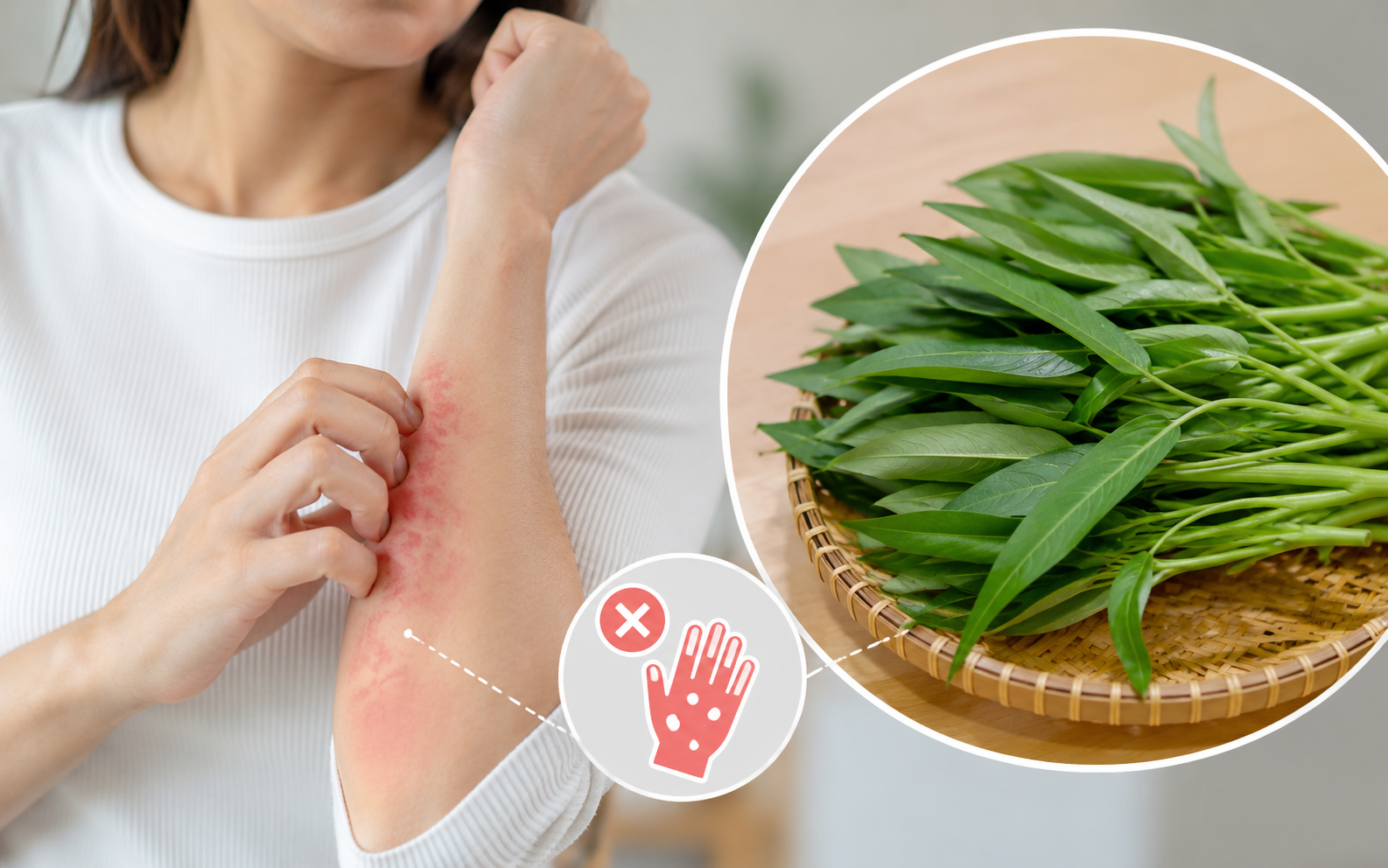Người đã có tiền sử dị ứng rau muống nên kiêng tuyệt đối