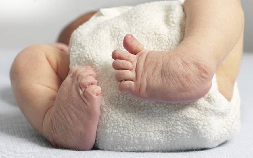 phẫu thuật dị tật bẩm sinh ở chân